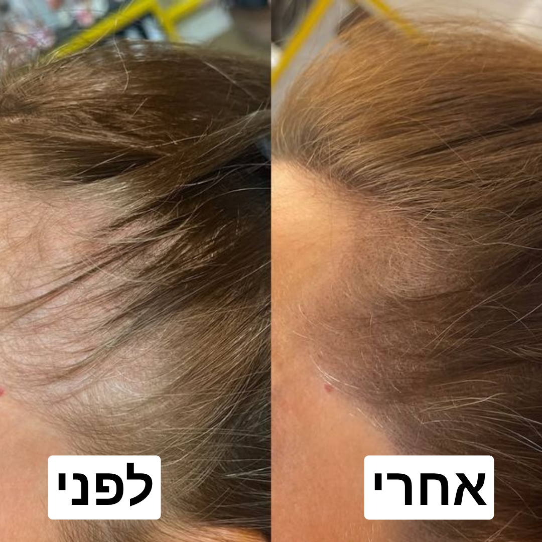 HairGlow מבית Silora